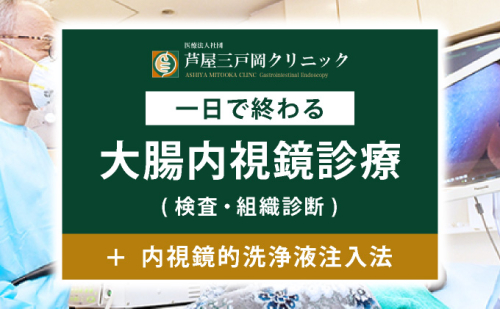 1日で終わる 大腸内視鏡診療（内視鏡的洗浄液注入法プラン） (日帰り) 1名様【芦屋三戸岡クリニック】消化器内視鏡専門クリニック 大腸検査 内視鏡検査 大腸がん 大腸ポリープ などの 早期発見 早期対策 早期治療 健康 カウンセリング 2203684 - 兵庫県芦屋市